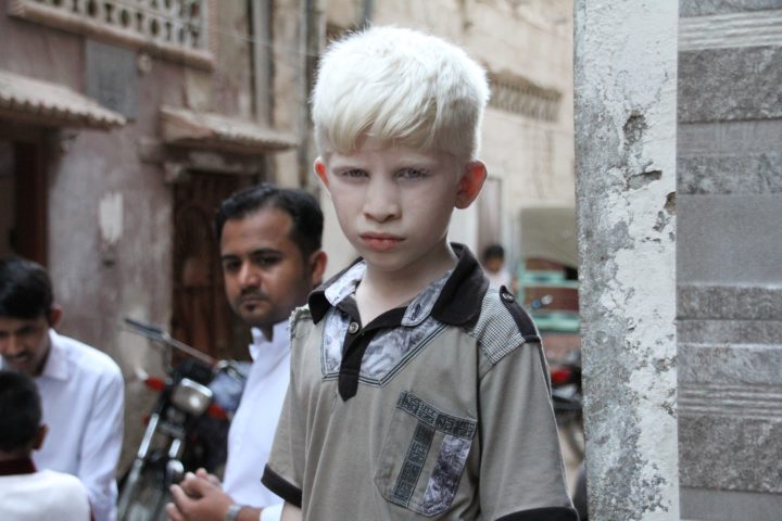 albino-3438707_1920