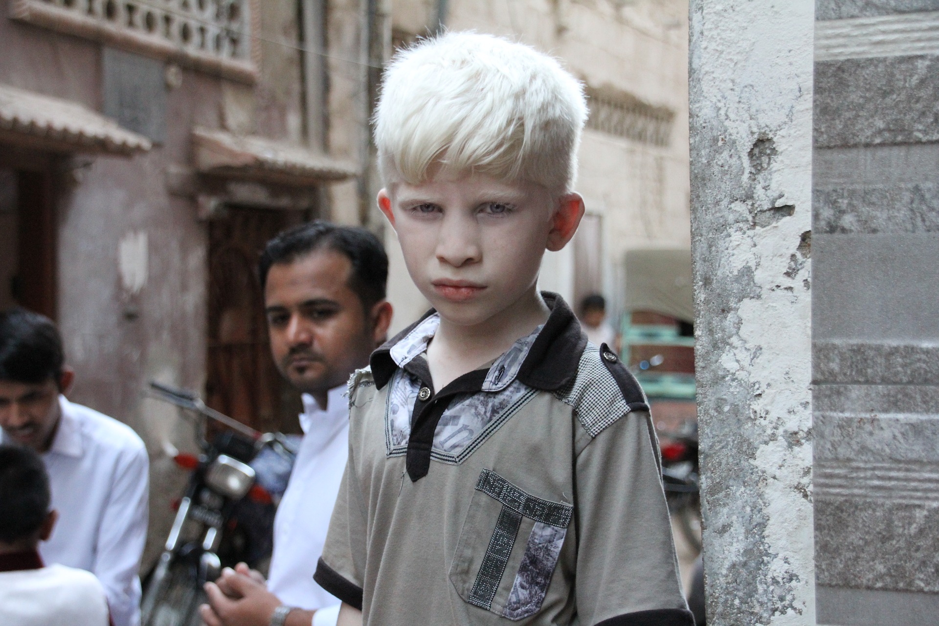 The Harmful Invisibility Of People With Albinism Samuel Centre For 